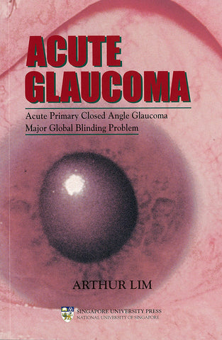 Acute Glaucoma: Acute Primary Closed Angle Glaucoma. Major Global Blinding Problem